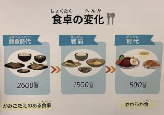 お口と顎の変化 インビザライン 名古屋の矯正歯科治療 イオンモール新瑞橋内 はプルチーノ歯科 矯正歯科 お口と顎の変化 インビザライン 名古屋の矯正歯科治療 イオンモール新瑞橋内 はプルチーノ歯科 矯正歯科