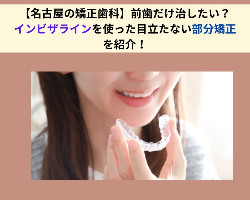 名古屋の矯正歯科】前歯だけの部分矯正！インビザラインによる目立た