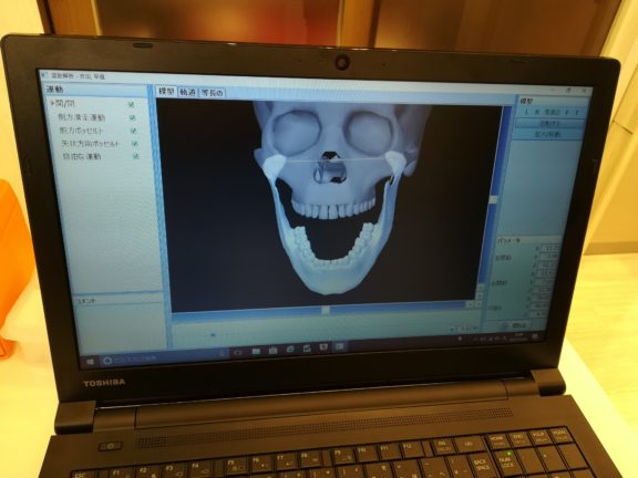 ディグマが導入されます！ | 名古屋でインビザライン矯正・小児矯正